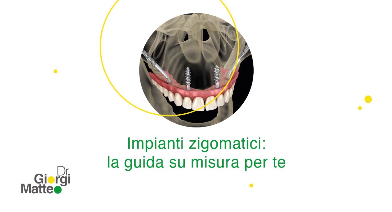 impianti zigomatici