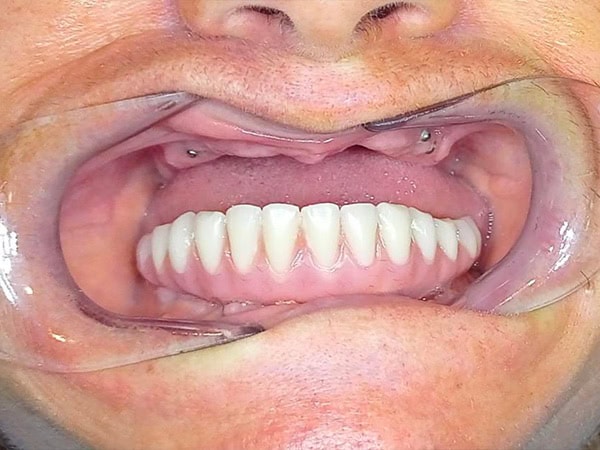 Giorgi_caso_clinico_Giusy_1