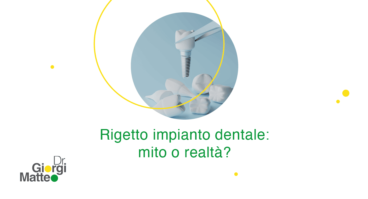 rigetto impianto dentale